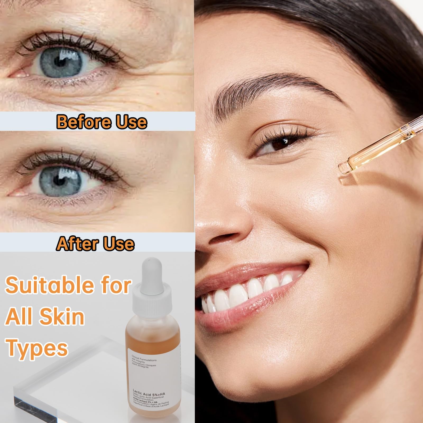 Lactic Acid Serum For Women, 30ML Moisturizing Lactic Acid 5% + Hyaluronic Acid Face Serum For Exfoliating, Exfoliating Serum For Dry Skin.